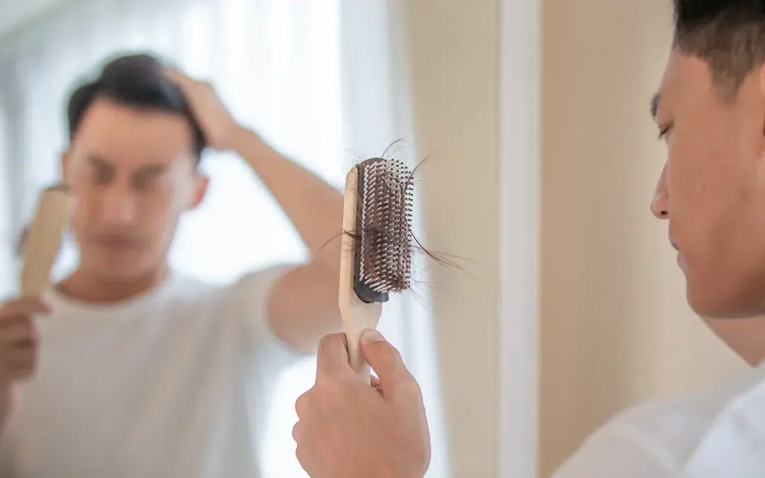 korean man worry about hair loss