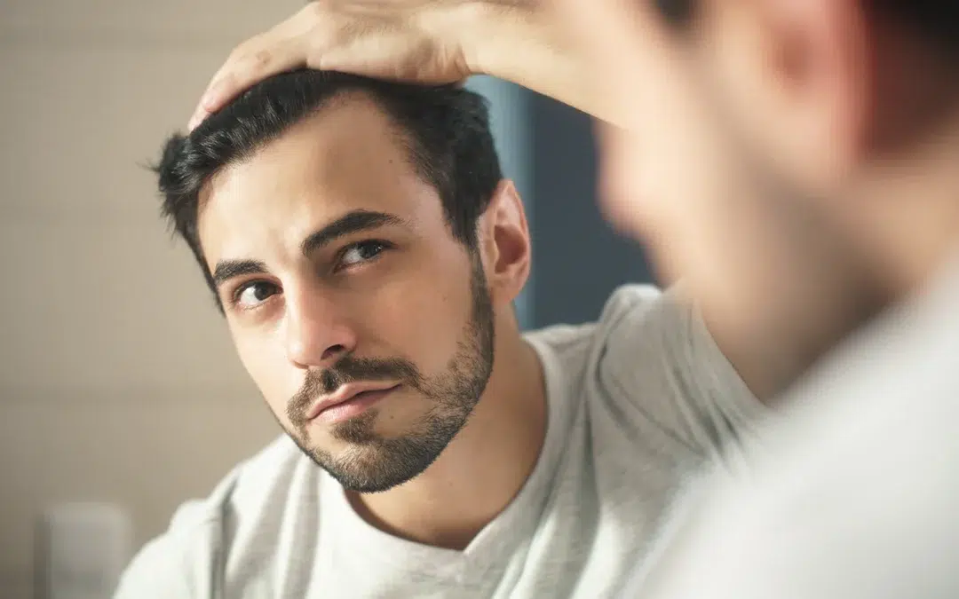 man worried for receding hairlines